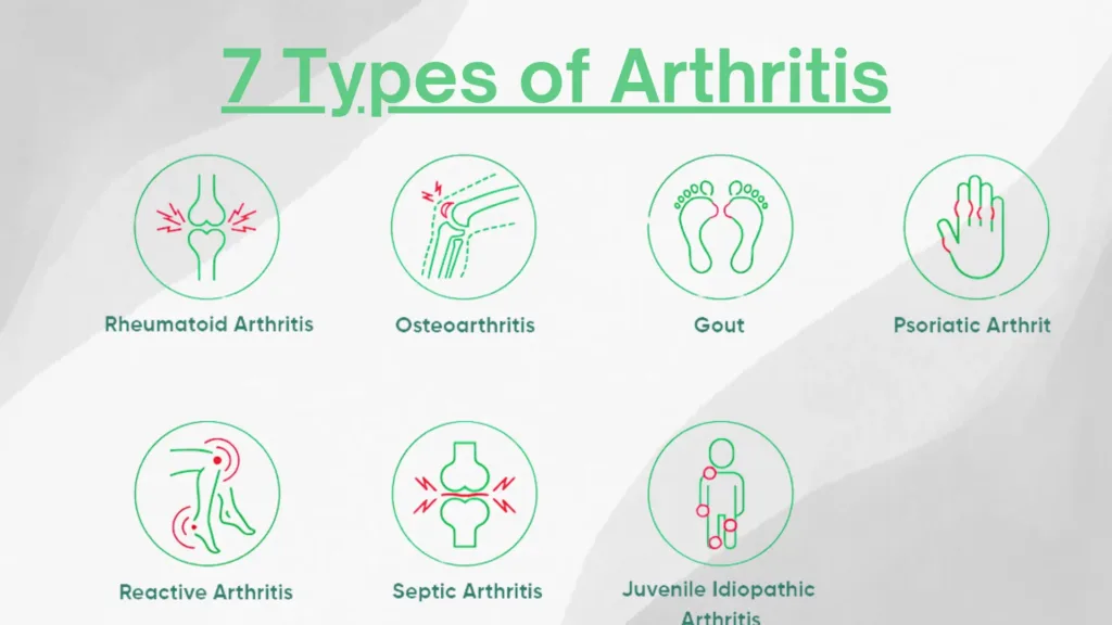 Infographic showcasing 7 types of arthritis, including osteoarthritis, rheumatoid arthritis, gout, psoriatic arthritis, lupus, ankylosing spondylitis, and juvenile arthritis. The infographic highlights the common joints affected by each type, providing a clear visual representation of how arthritis impacts the body.